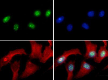 Histone H3 R8me2a Antibody