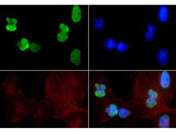 Histone H3 K9ac/K14ac Antibody