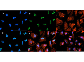Histone H3 K9ac/K14ac Antibody