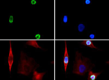 Histone H3 phospho S28 Antibody