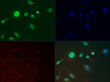 Histone H3 K36me3 Antibody