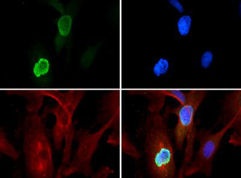 Histone H3 K56me3 Antibody