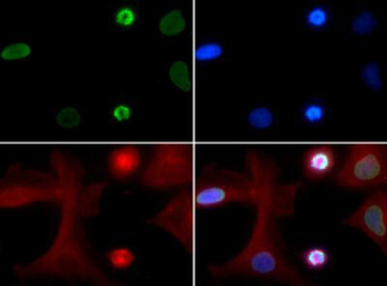 Histone H4 K5ac Antibody