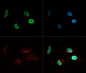 Histone H4 K8ac Antibody