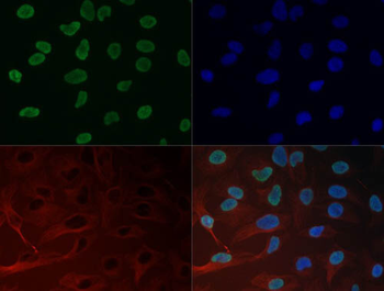 Histone H3 K27me3 Antibody