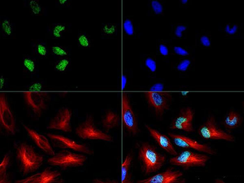 Histone H3 pT3/R2me2s Antibody