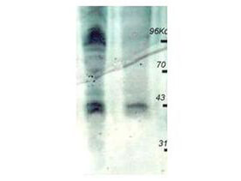 Phosphothreonine Antibody Peroxidase Conjugated