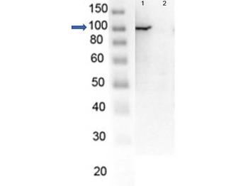 PARP1 (N-term ZF1) Antibody Set