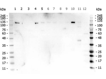PARP1 (N-term ZF1) Antibody Set