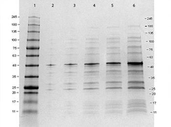 12 Epitope Tag Control Lysate (GST)