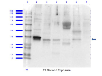 CLIC1 Antibody