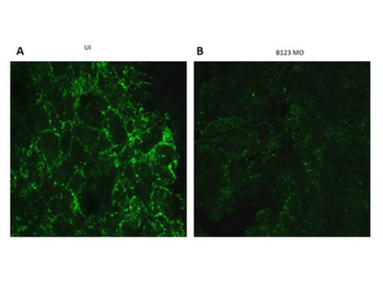 Ephrin B1, B2, B3 Antibody