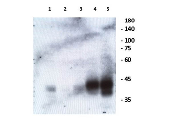 Ephrin B1, B2, B3 Antibody