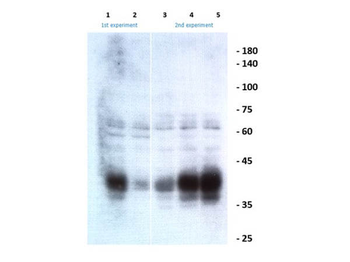 Ephrin B1, B2, B3 Antibody