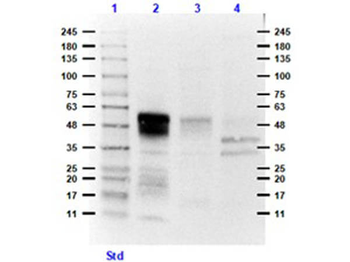 Ephrin B1, B2, B3 Antibody