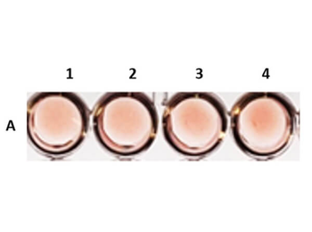 Sheep Hemagglutination ELISA Kit