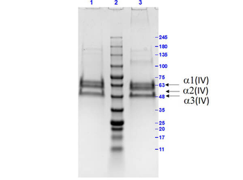 Bovine Collagen Type IV protein