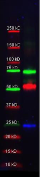 Alpha-1-Anti-Trypsin Antibody