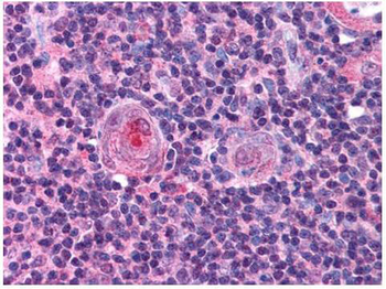 NFYB Antibody