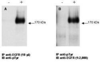EGFR Antibody