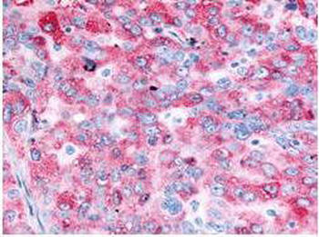 EGFR Antibody