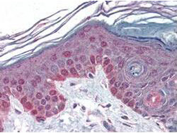 CCNT1 Antibody