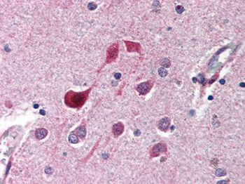 CDK5 Antibody