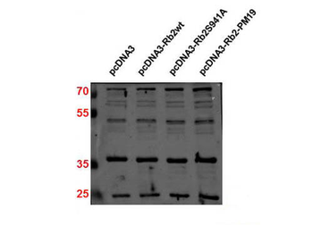 CDKN1B Antibody