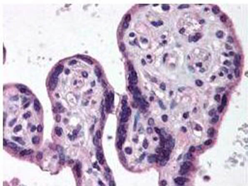 IKBKB Antibody