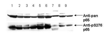 RELA Antibody