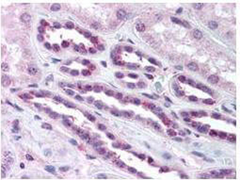 RELA Antibody