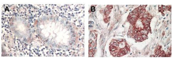 AKT1 Antibody