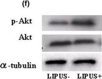 AKT1 Antibody