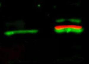 AKT1 Antibody