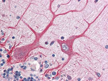 NOTCH1 Antibody
