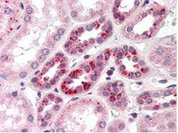 NOTCH2 Antibody