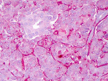 NOTCH1 Antibody