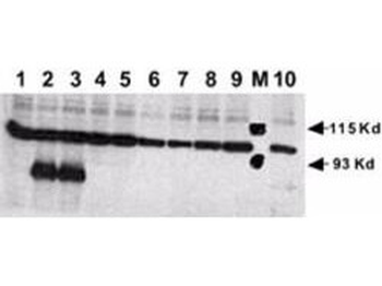 NOTCH1 Antibody