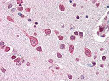 CUL7 Antibody