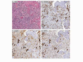 AHSP Antibody