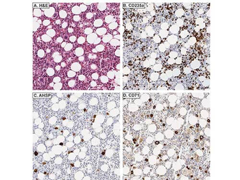 AHSP Antibody
