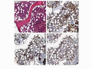 AHSP Antibody