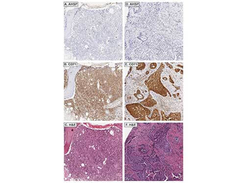 AHSP Antibody