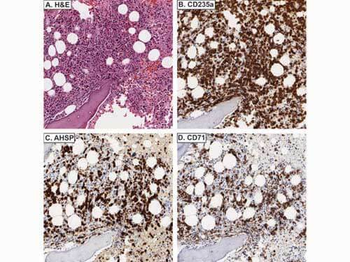 AHSP Antibody
