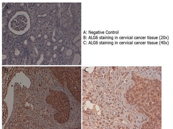 ALG6 Antibody