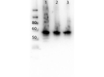 ALG6 Antibody