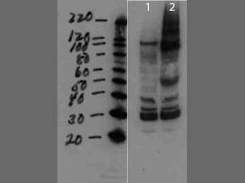 env Antibody