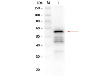 ALD2 Antibody