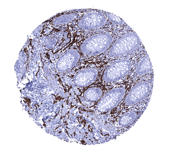 CD56 antibody