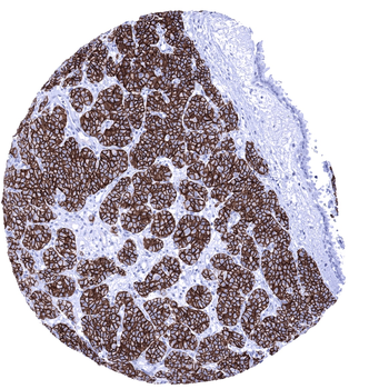 CD56 antibody